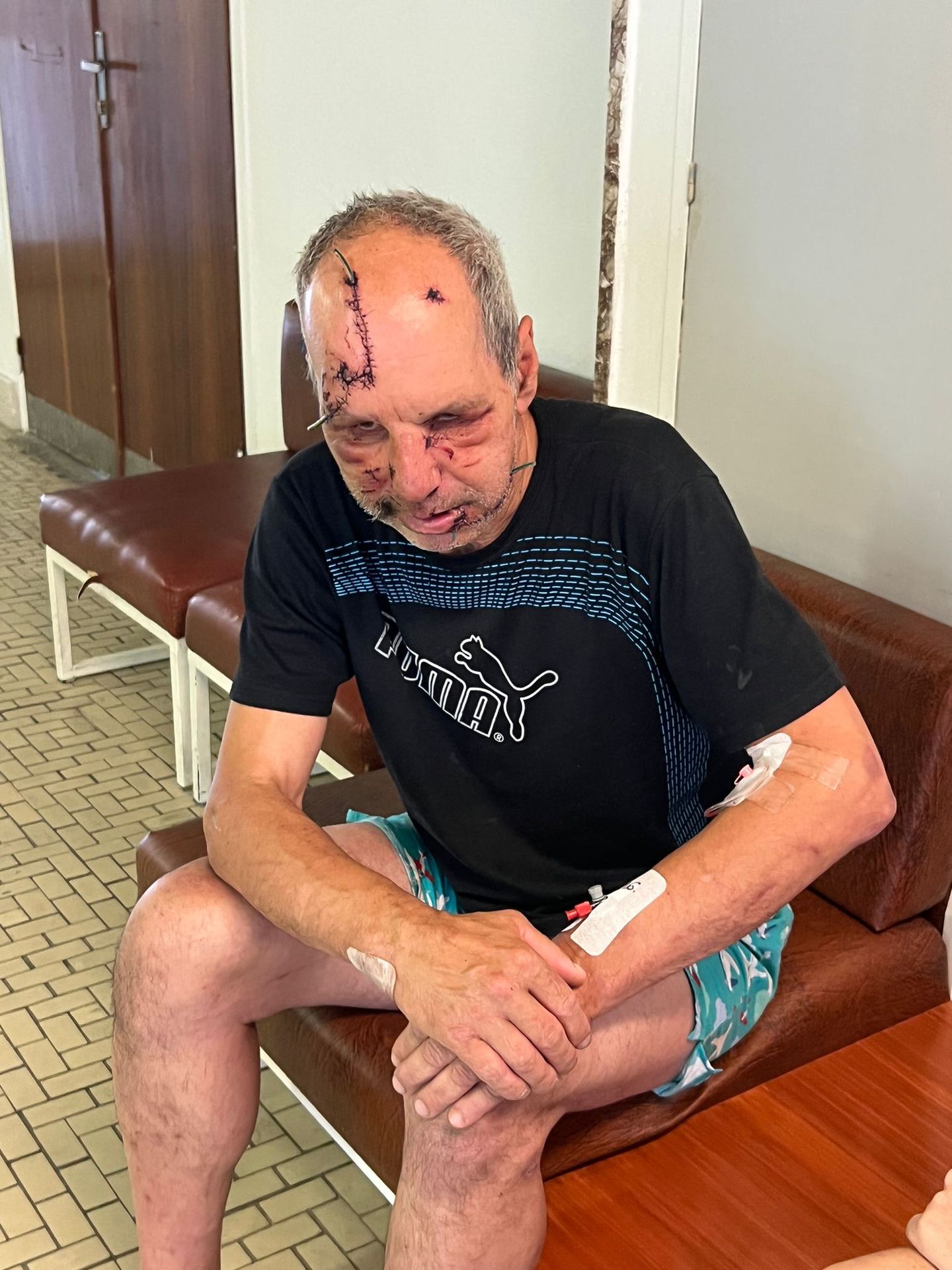 Napadnutý muž tri dni po útoku