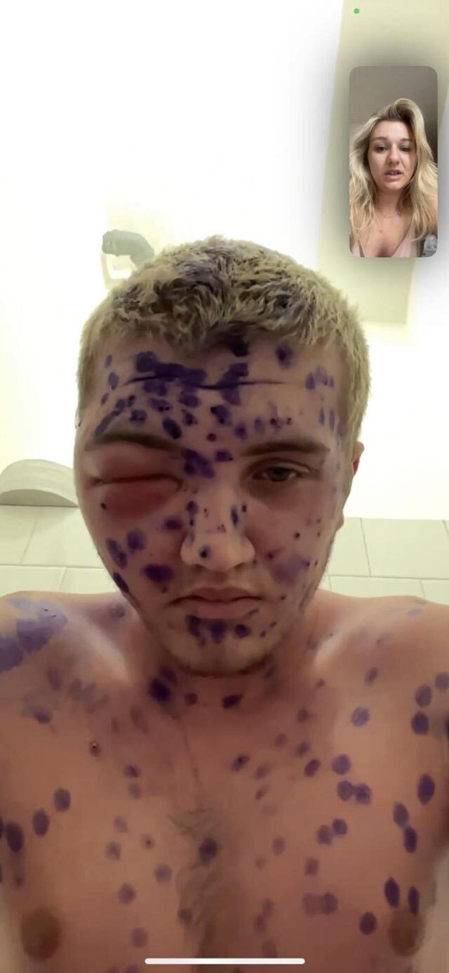 Kiahne spustili lavínu zdravotných problémov