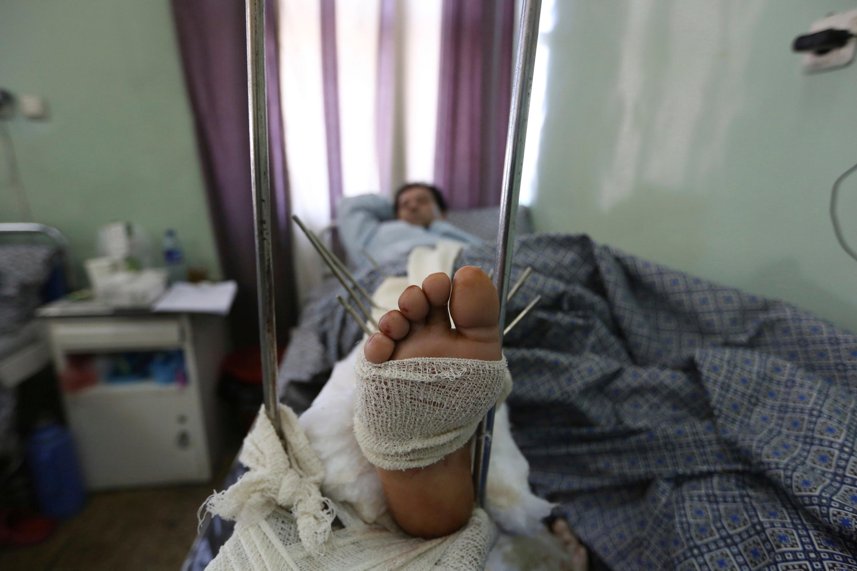 Najväčšia vojenská nemocnica v Kábule po útoku IS. 