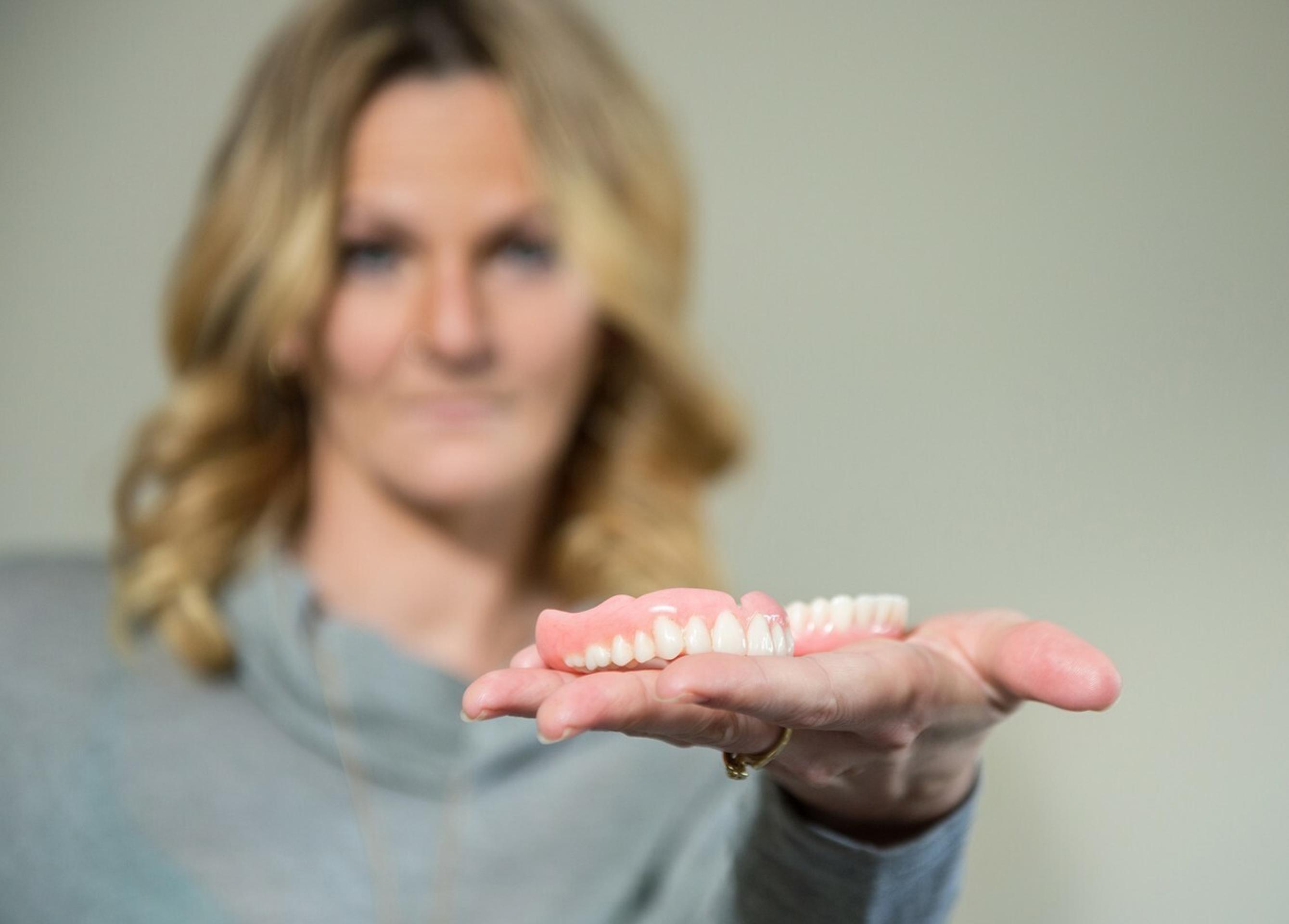 Skye Simpsons prišla o zuby.