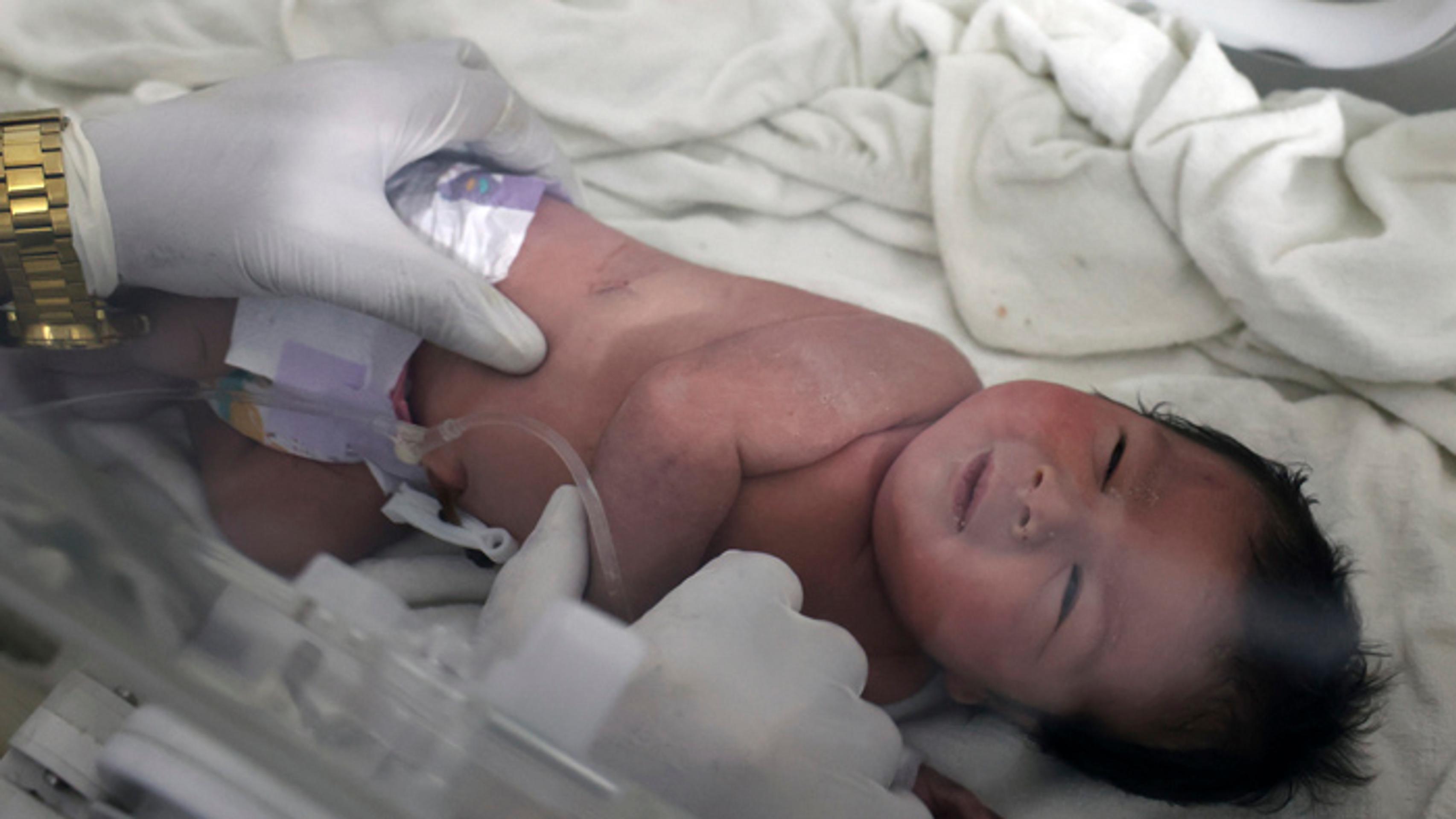 Ája leží v inkubátore v detskej nemocnici v sýrskom meste Afrín.