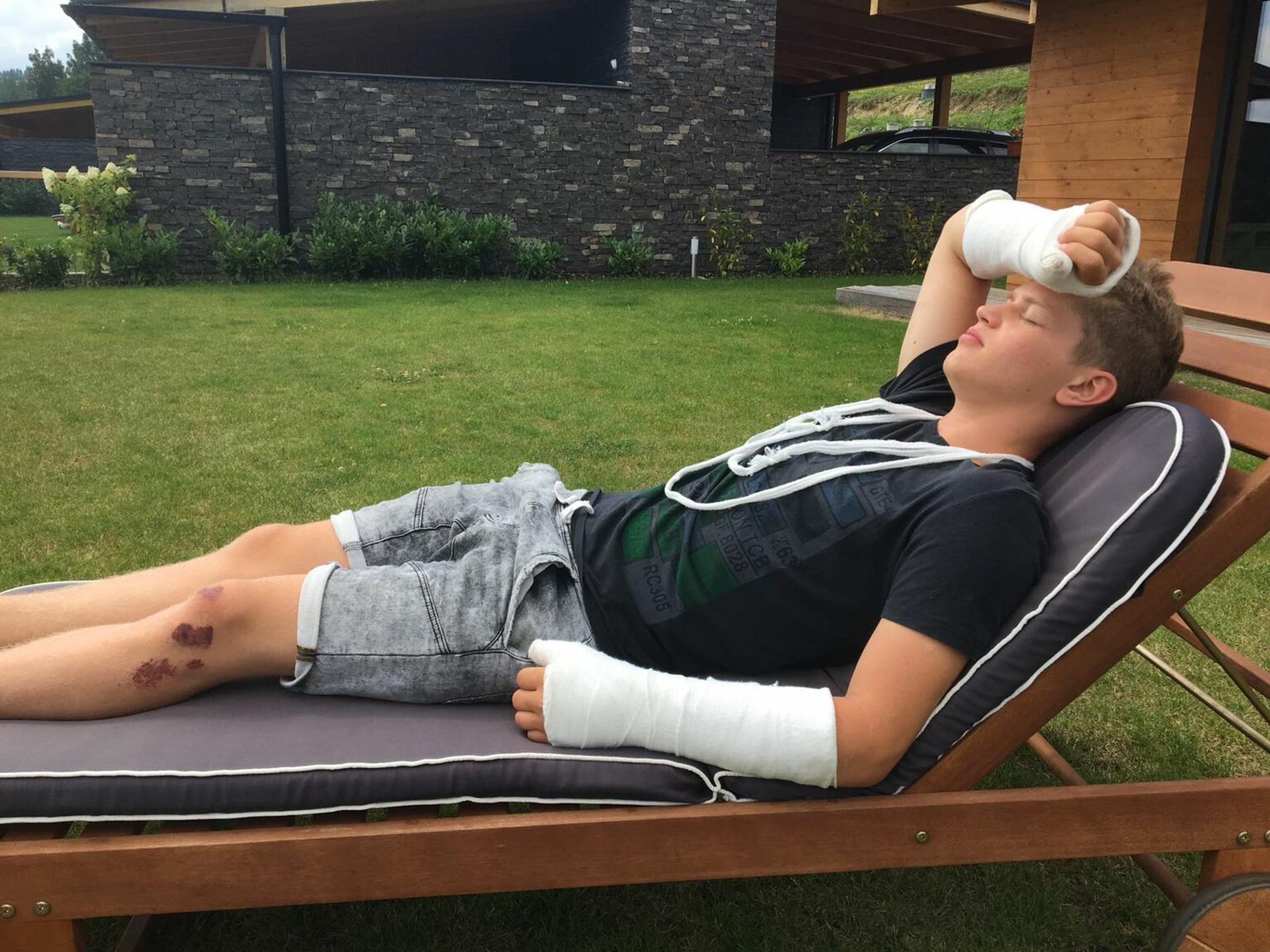 Oliver Oswald po nehode! 