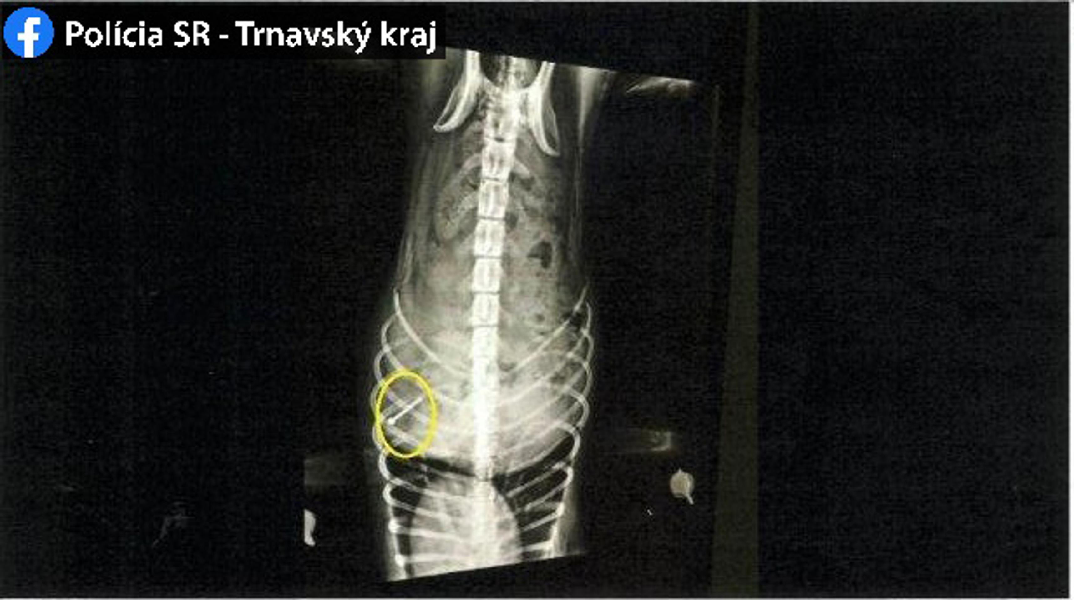 Pani Danka žila 12 rokov s tyranom. Pálil ju cigaretami, bil tĺčikom i rezal ruky.