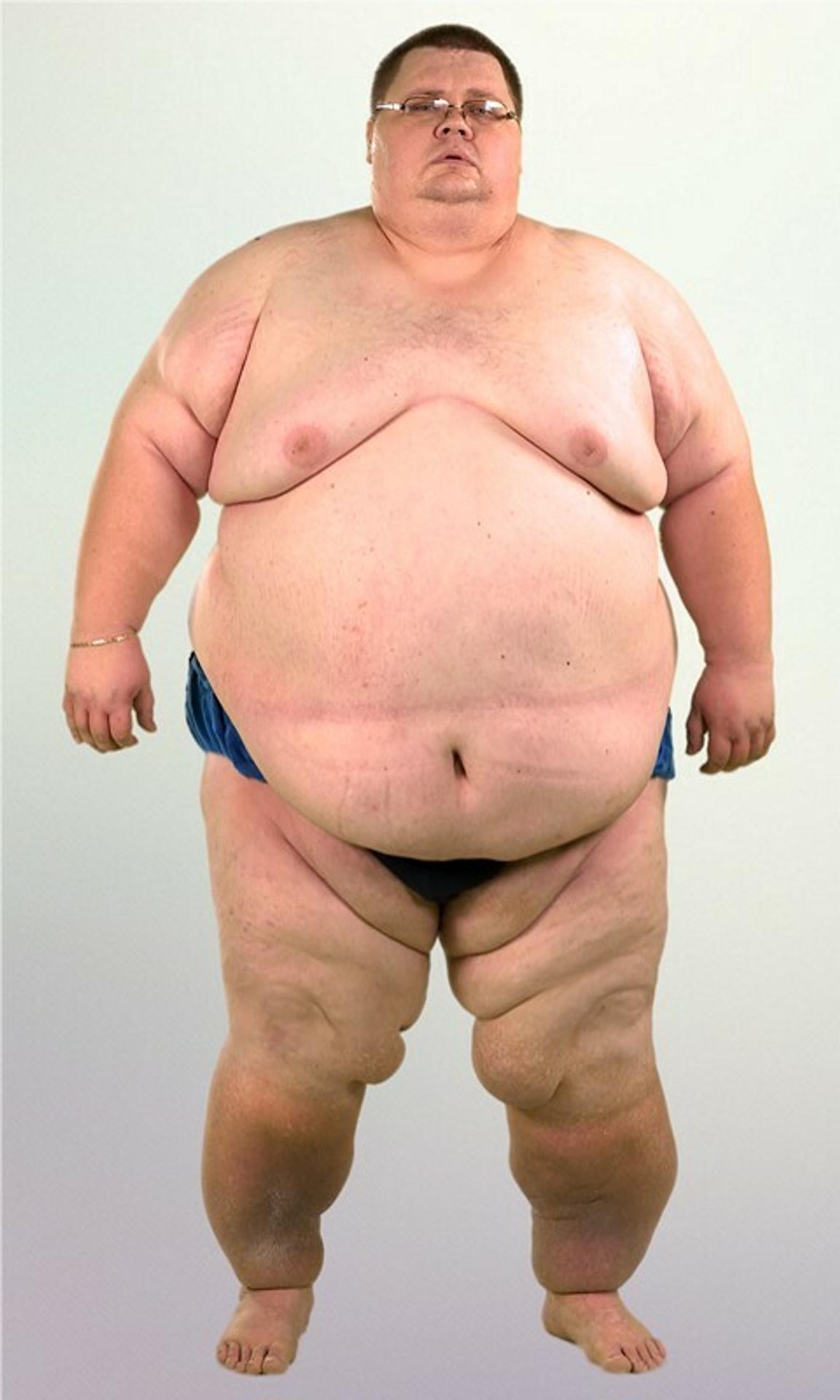 Ján Hodoň pred premenou vážil 287 kg