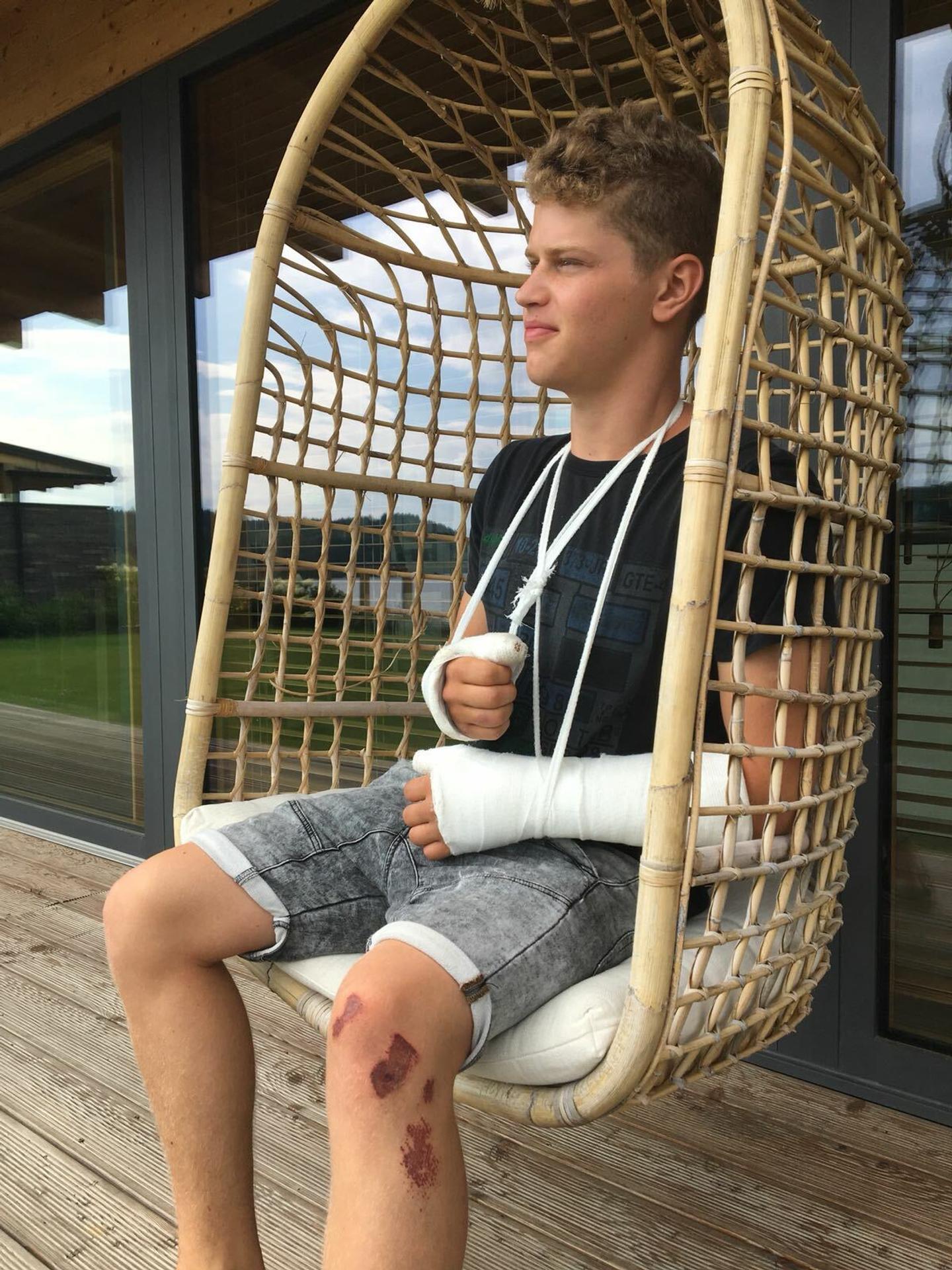 Oliver Oswald po nehode! 