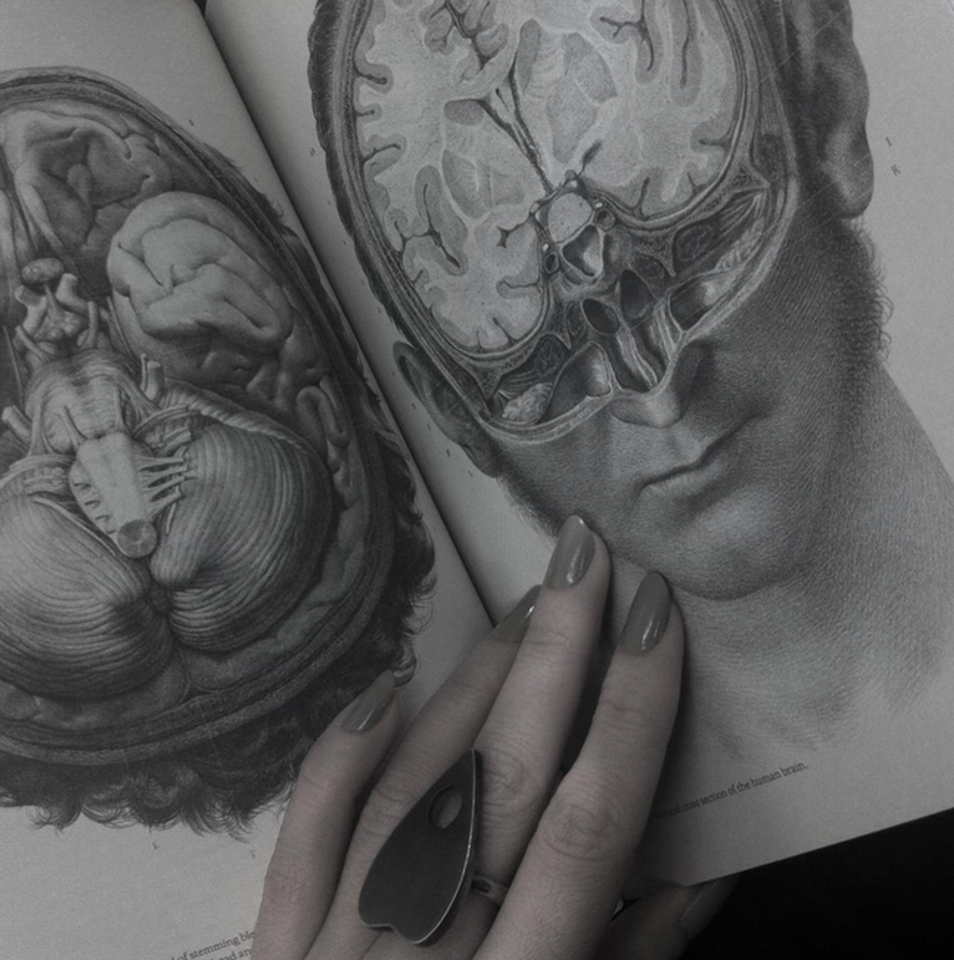 Crucial Interventions