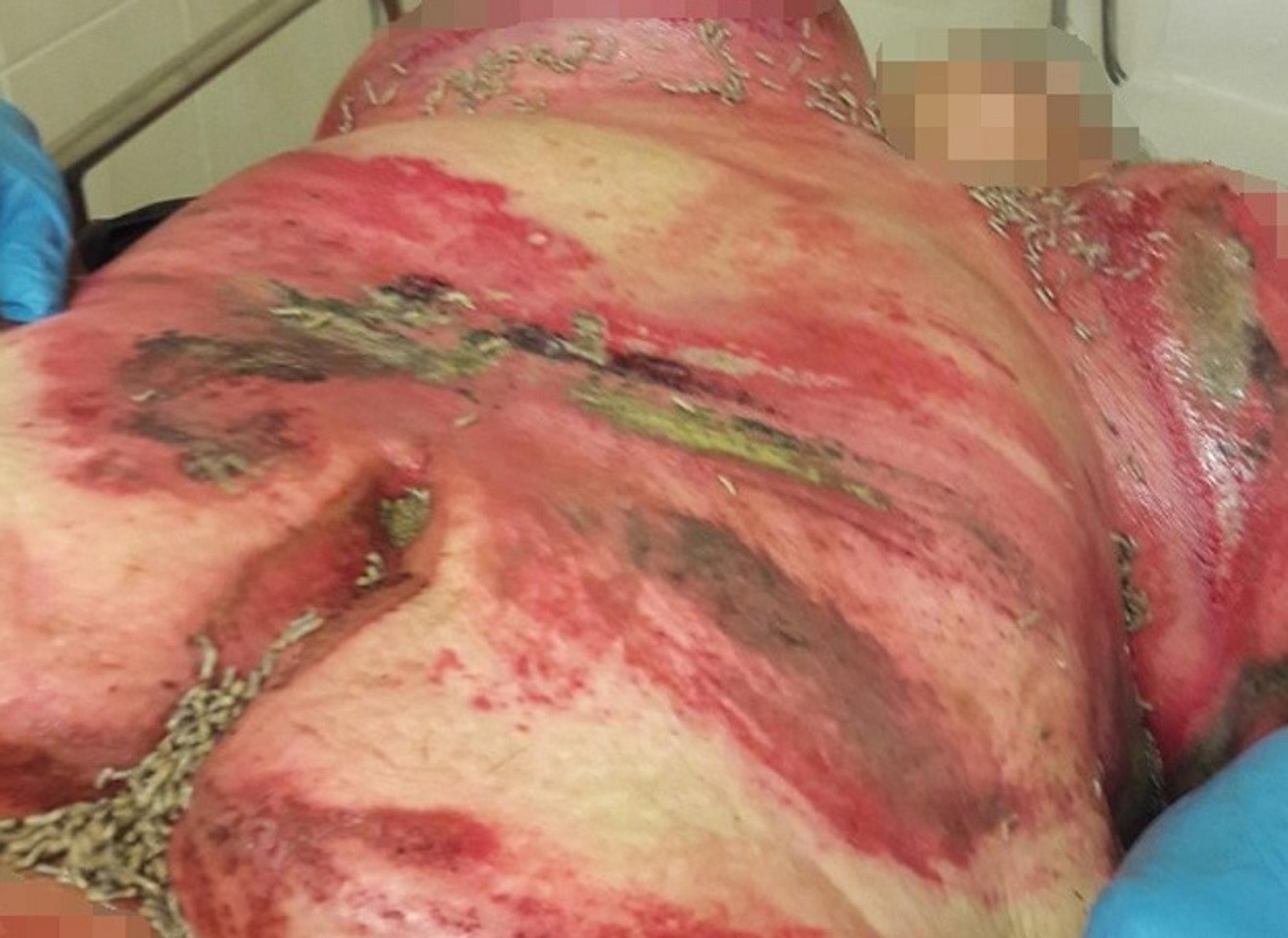 Žena sa sťažovala na bolesti.