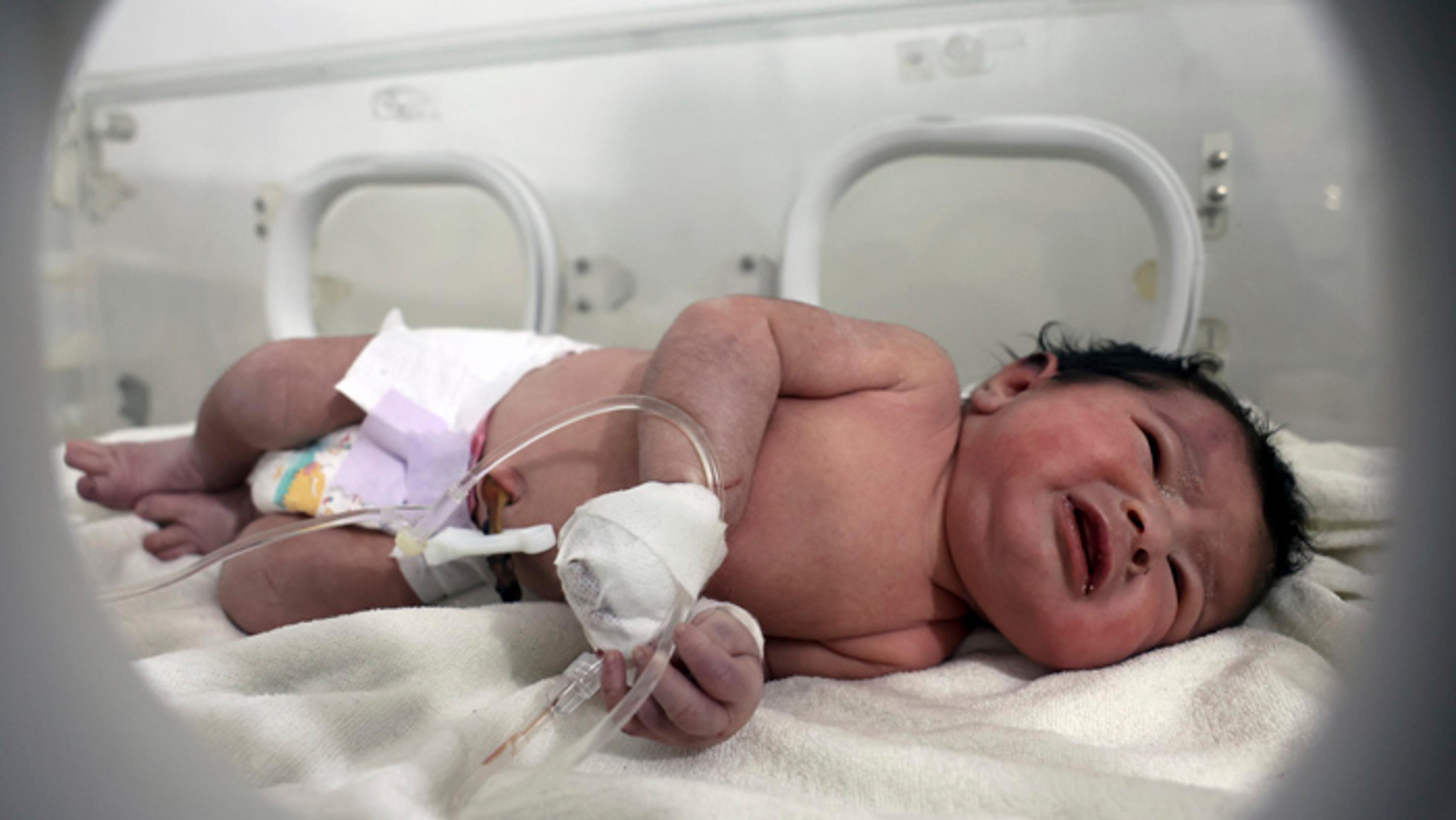 Dievčatko leží v inkubátore v detskej nemocnici v sýrskom meste Afrín.