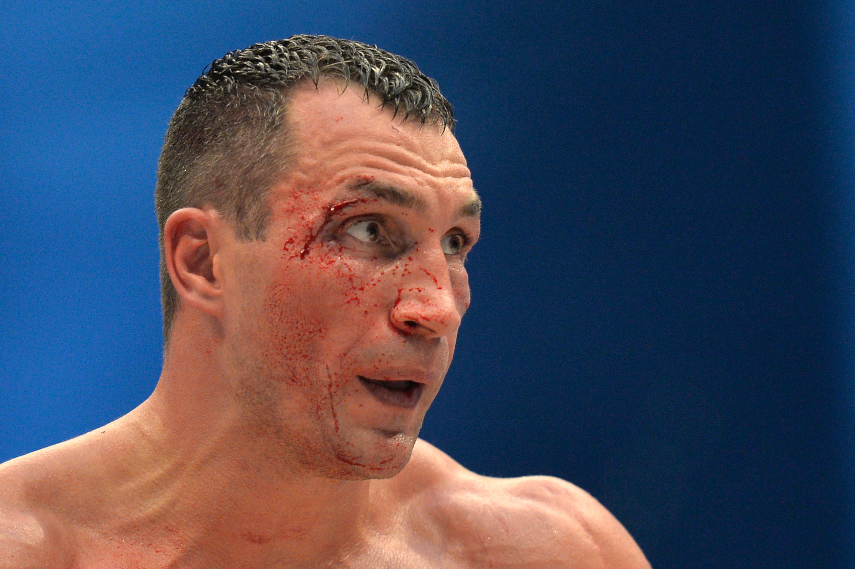 Netradičný pohľad na Vladimira Klička v ringu.