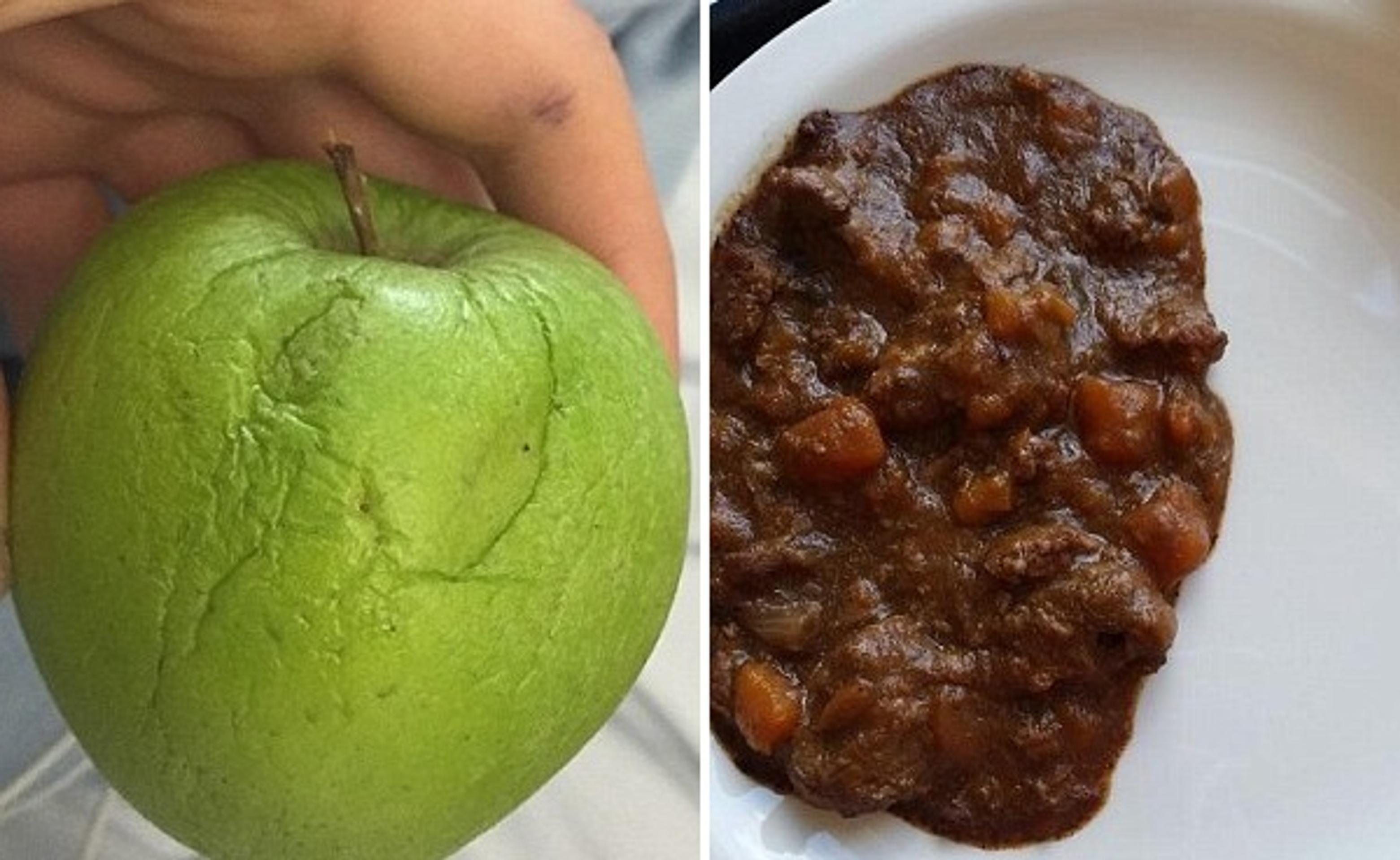 Toto príliš čerstvo nevyzerá - v nemocnici v Londýne.