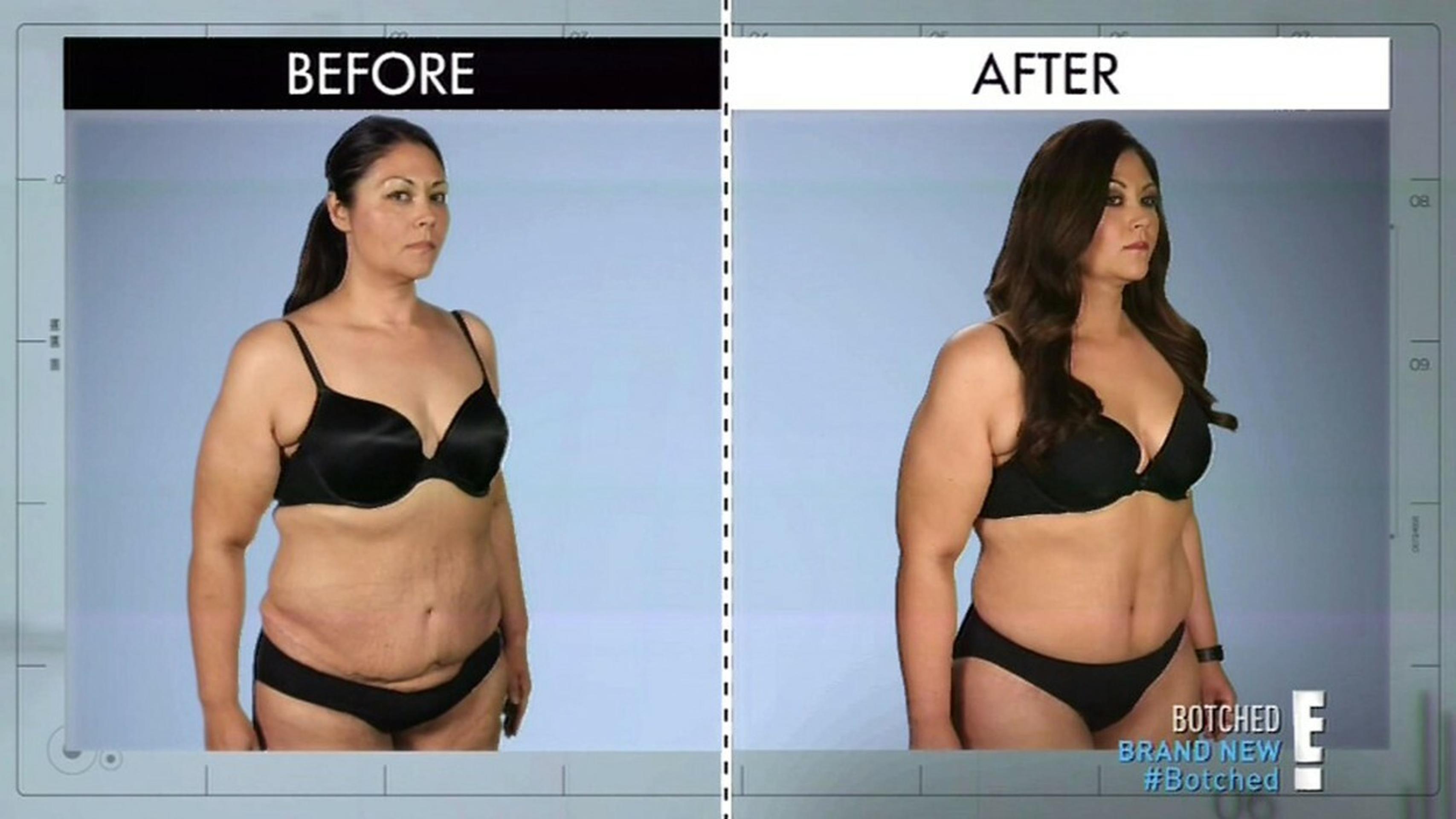 Samantha Taylor pred a po operácii.