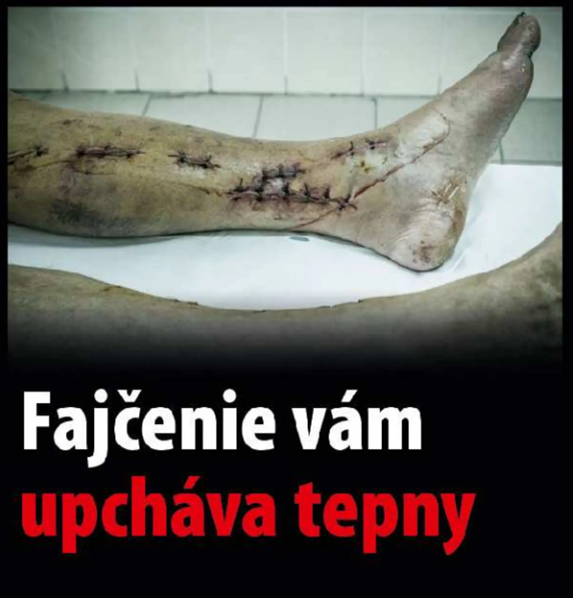 Varovanie, čo všetko môže spôsobiť fajčenie
