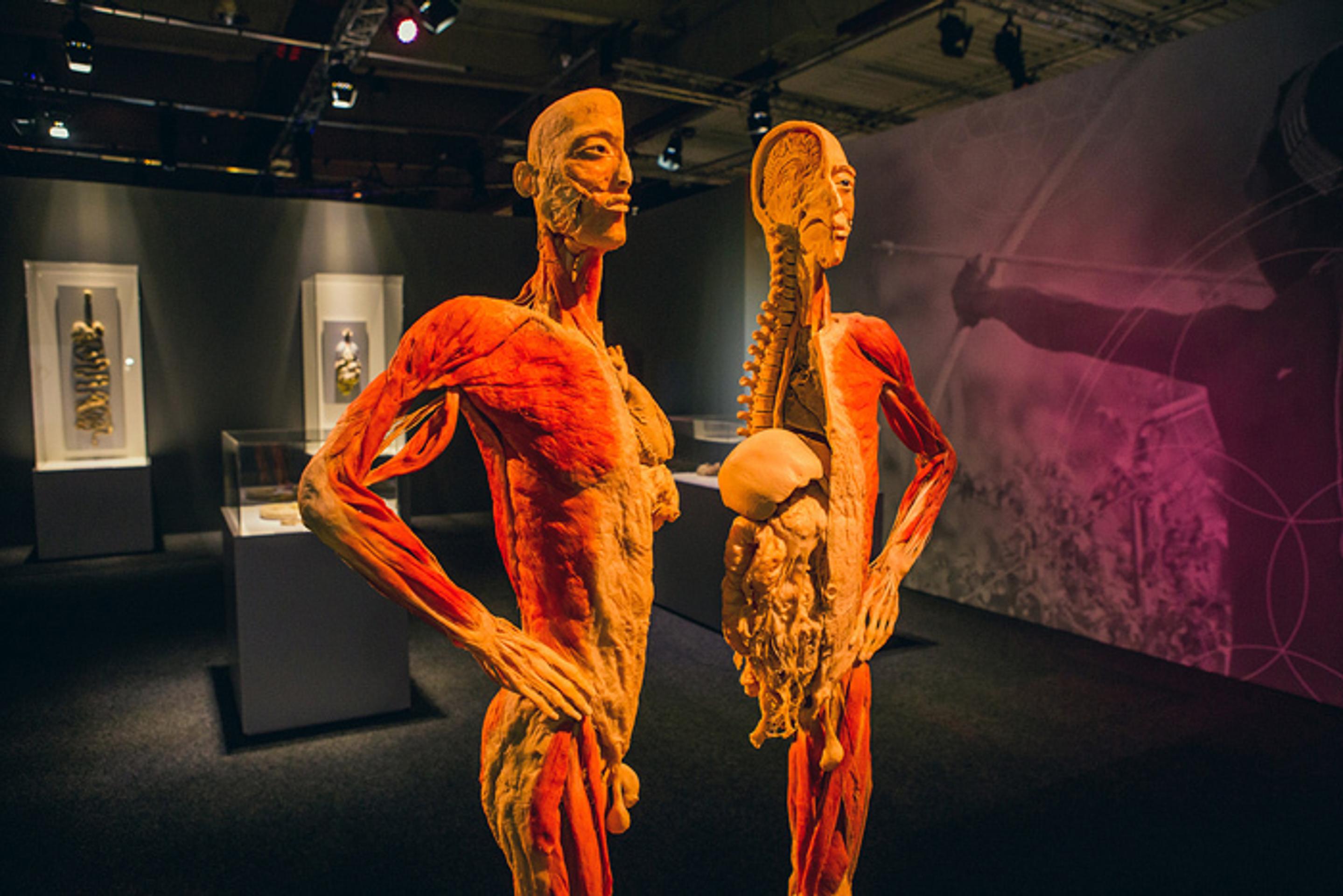 Exponát z výstavy Body The Exhibition.