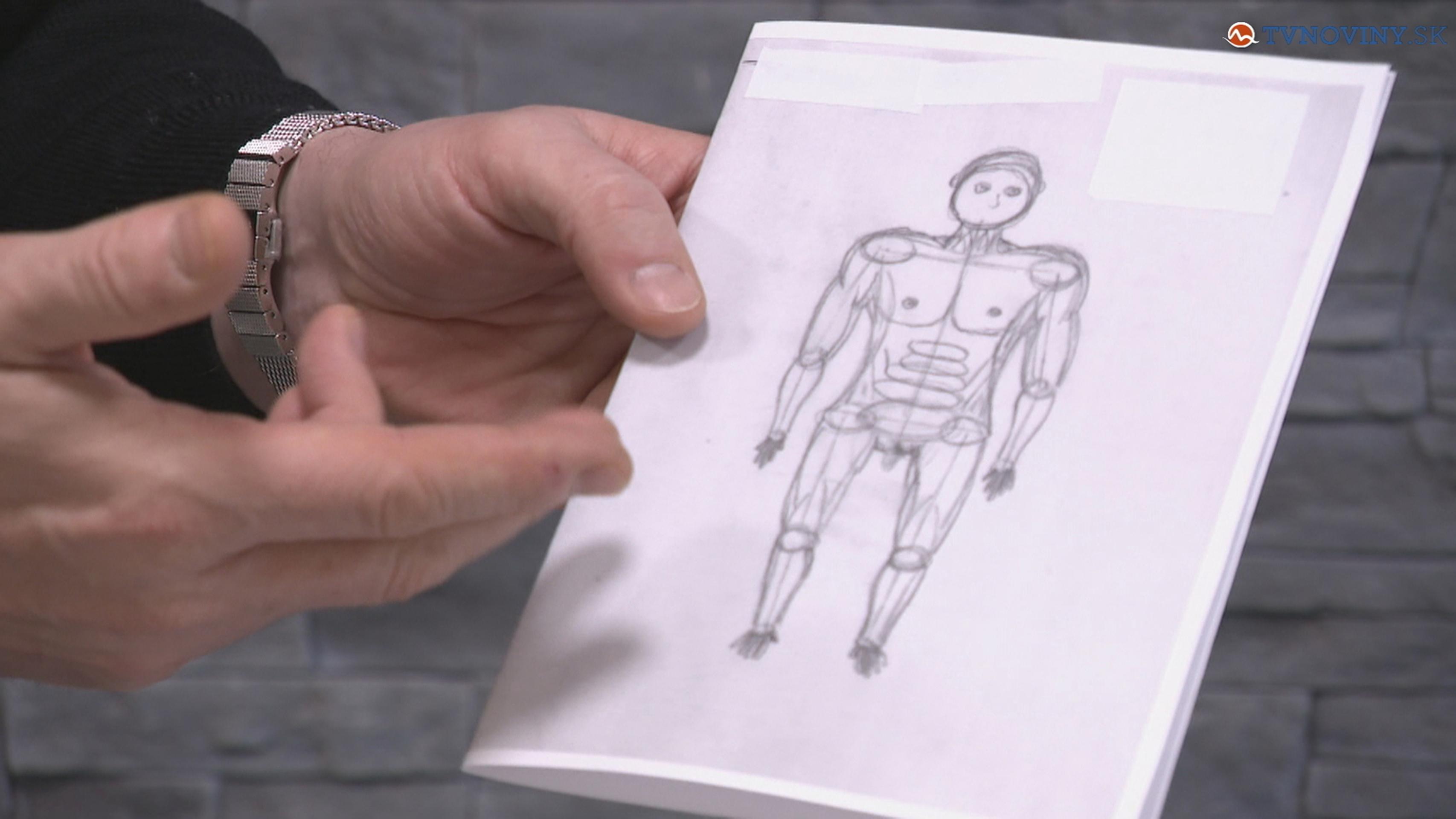 Obrázok je komentovaný v reportáži.