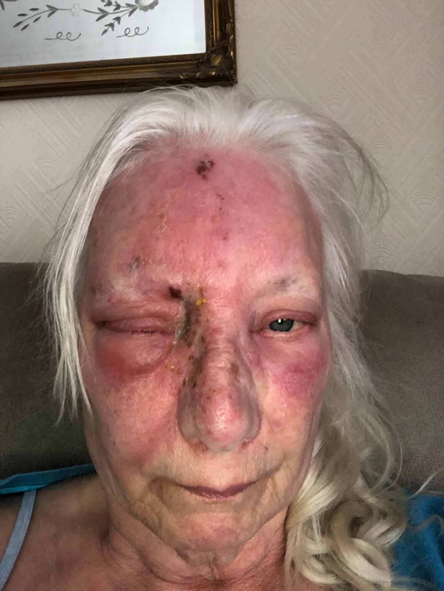 Reakcia Jean Hill na slnko.