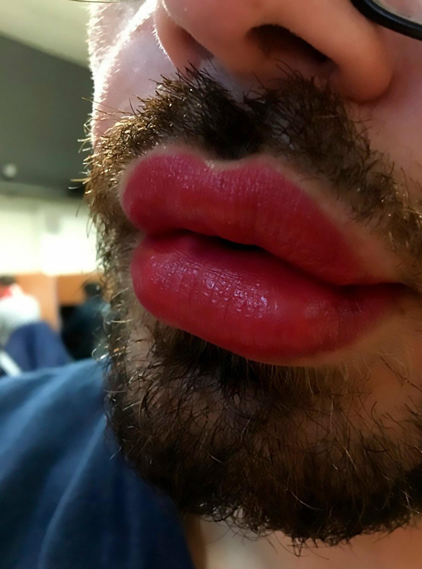 Fran Mariano po premene