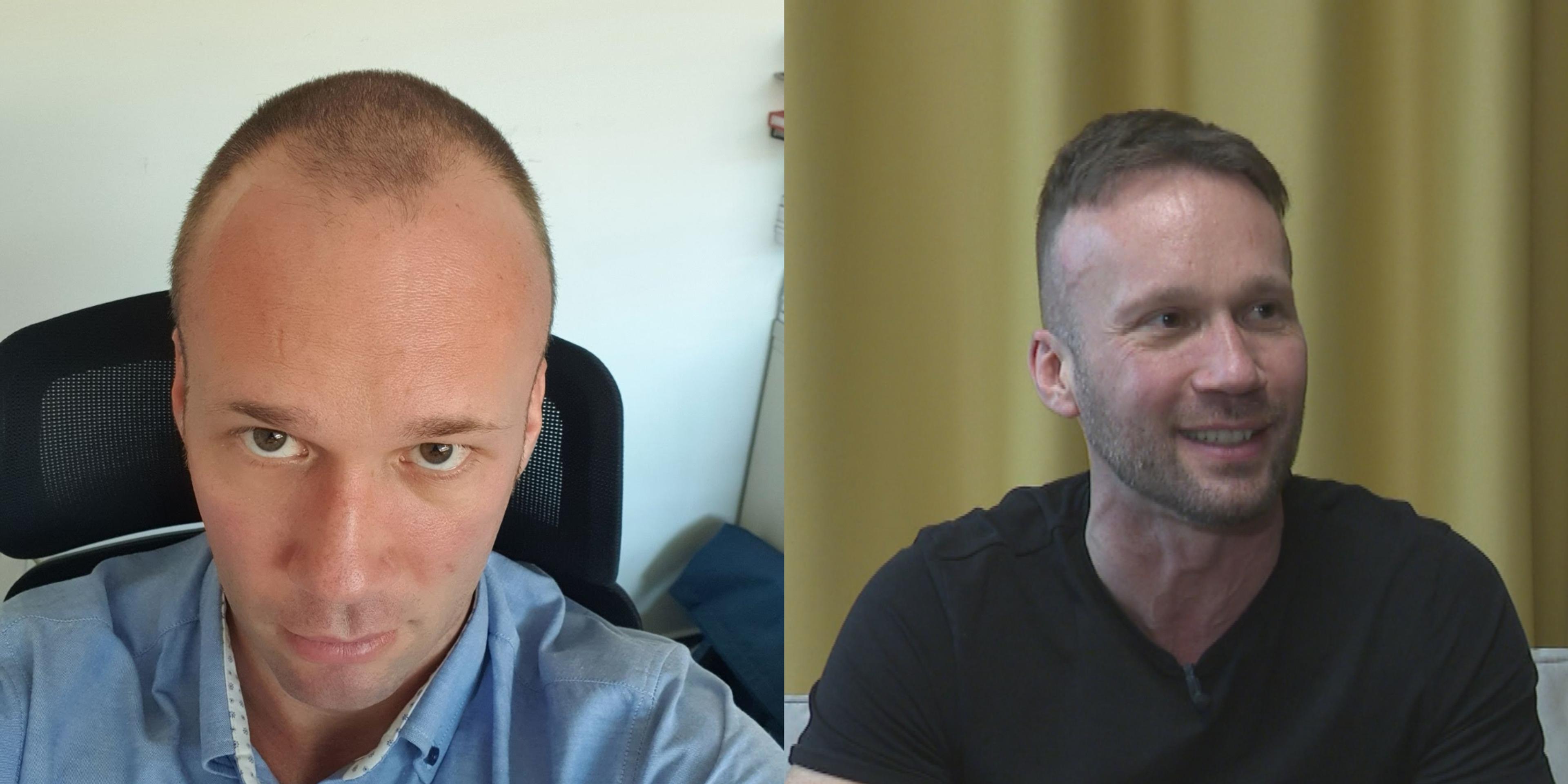 Roman pred (vľavo) a po zákroku.