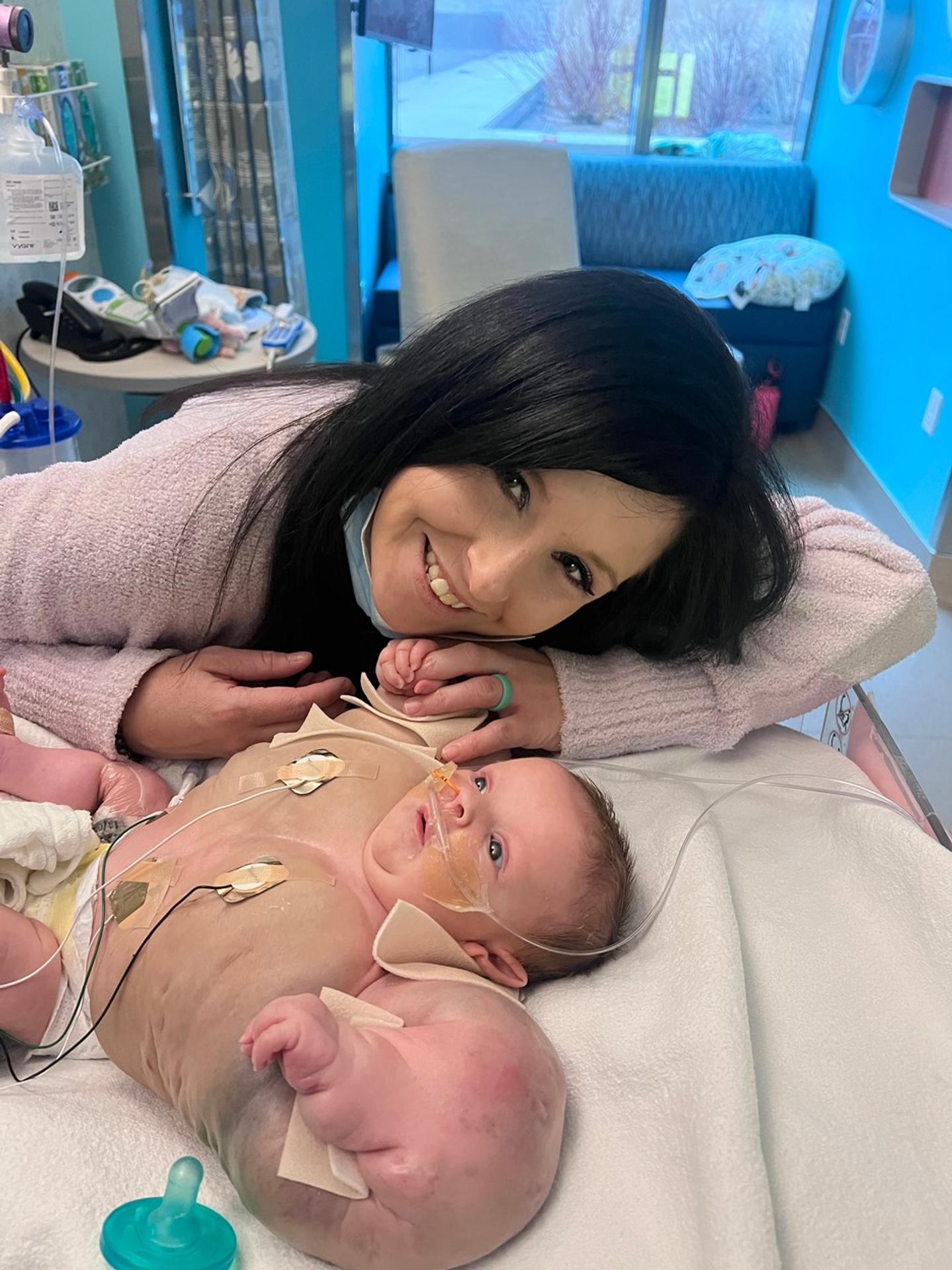  Armani Milbyová sa narodila so vzácnou genetickou poruchou.