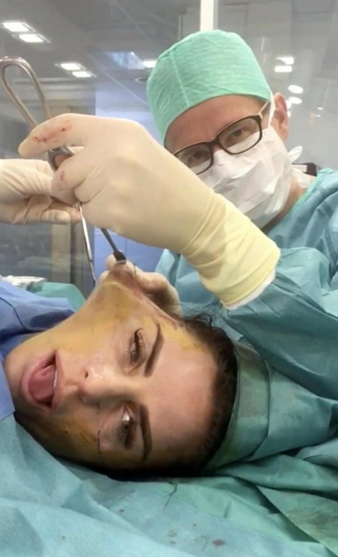 Katie Price počas chirurgického zákroku